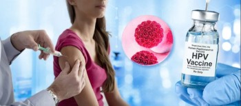 बर्दियाका ४ हजार बढी किशोरीलाई एचपिभी खोप दिने तयारी